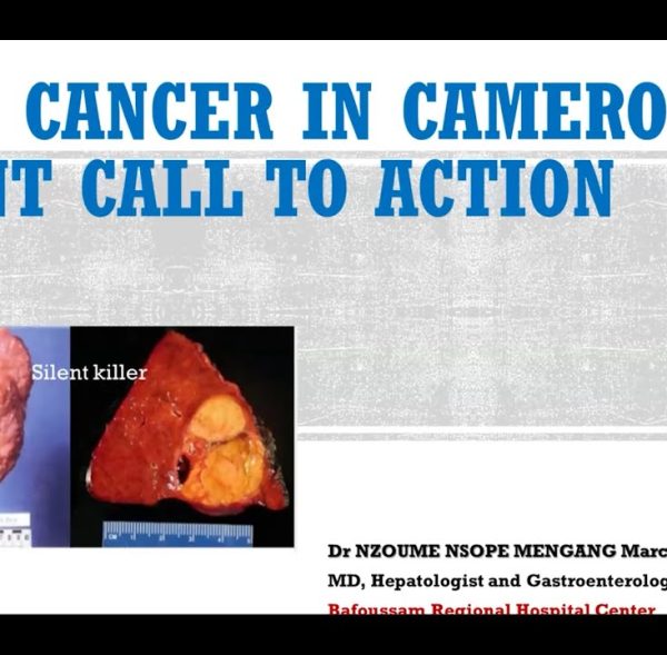 Liver Cancer in Cameroon Urgent Call To Action