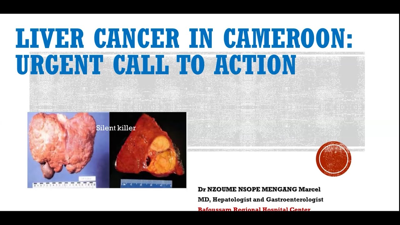 Prevention and Cancer Control in Cameroon